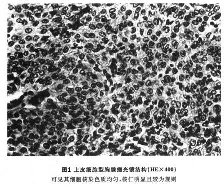 电镜下可见上皮细胞的张力原纤维和桥粒等特征(图2).