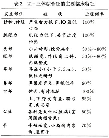 小儿21-三体综合征