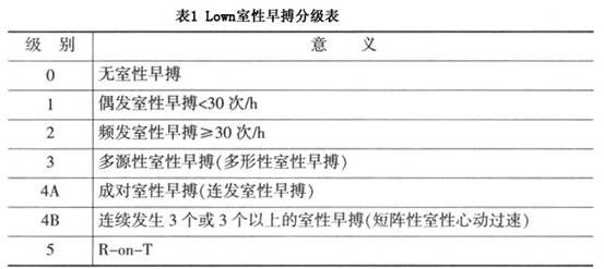 室性期前收缩