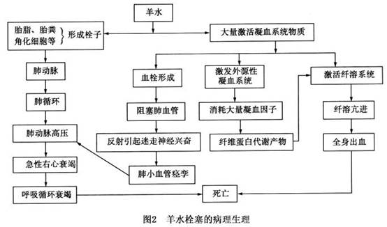 羊水栓塞