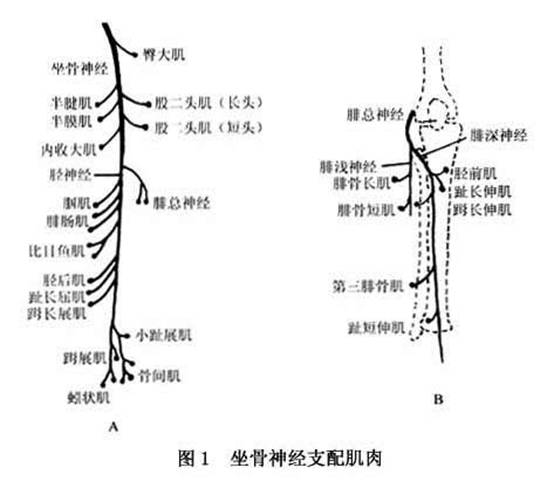 坐骨神经损伤