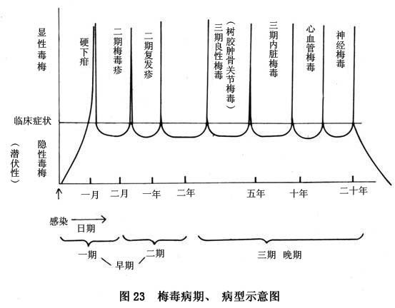 梅毒性关节炎