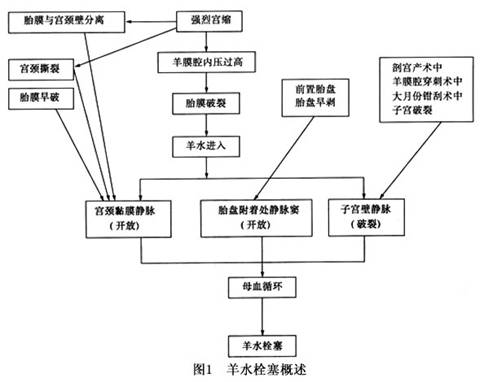 羊水栓塞