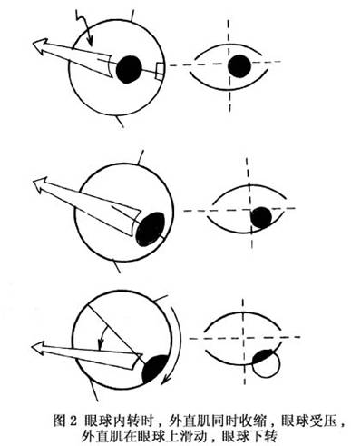 眼球内旋图片