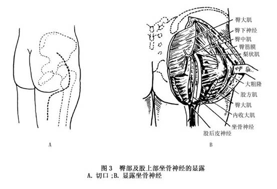 其各段損傷與局部解剖關係密切.