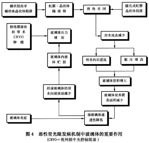 睫状环阻滞性青光眼