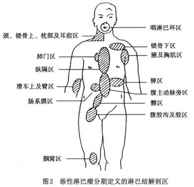 (2)播散方式:霍奇金淋巴瘤通常表现由原发灶沿淋巴路向邻近淋巴结