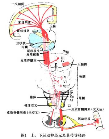 瘫痪