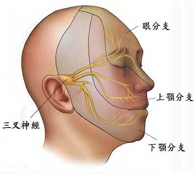 三叉神经1.jpg